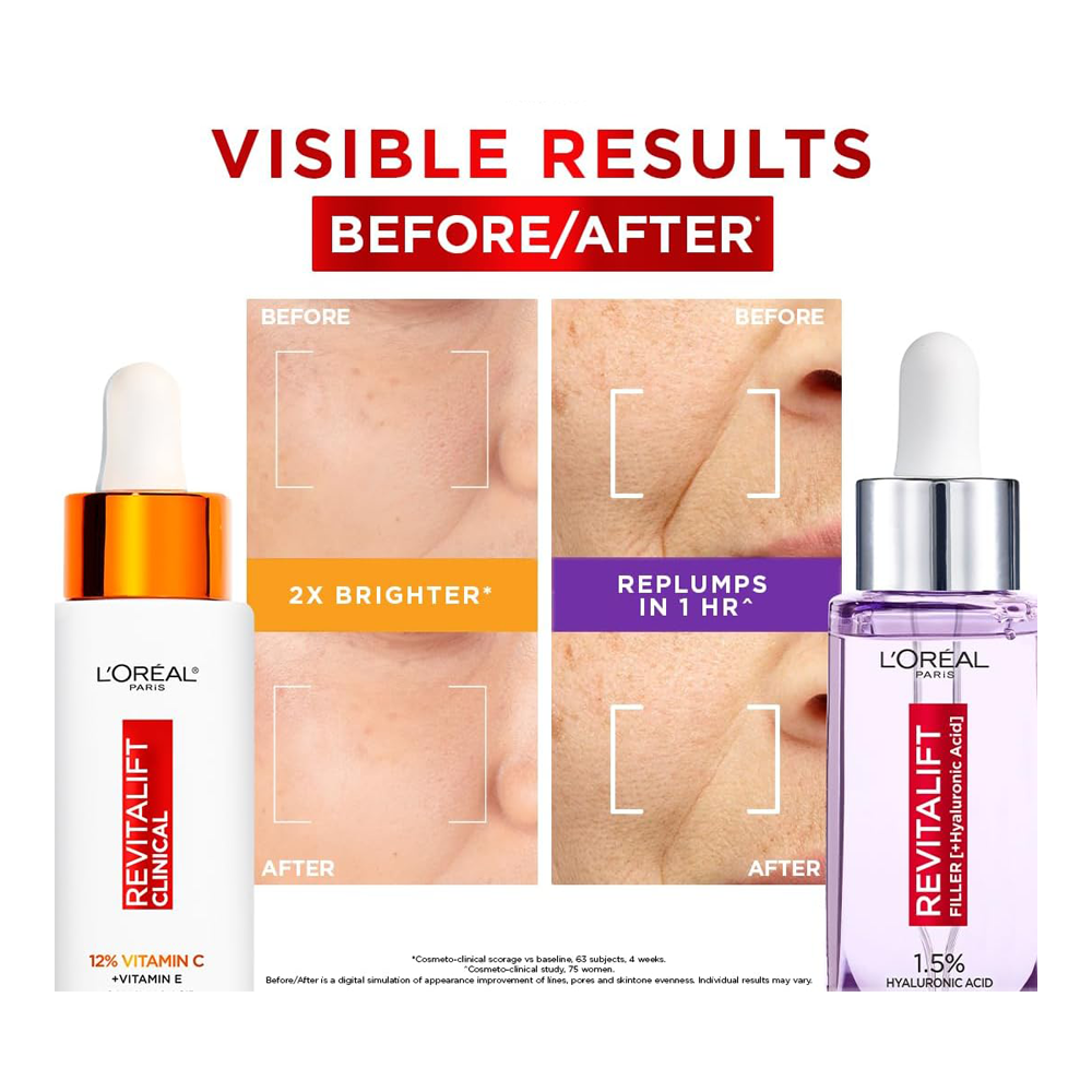 Before and after results using L'Oréal Cha-Cha Better Together Set for brighter, smoother skin