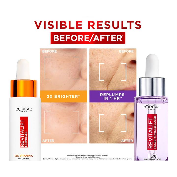 Before and after results using L'Oréal Cha-Cha Better Together Set for brighter, smoother skin