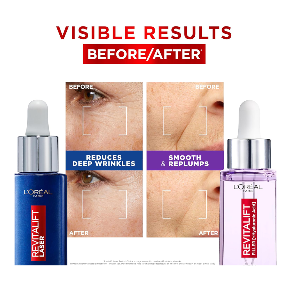 Before and after results using L'Oréal Day & Night Power Serums Set to reduce wrinkles and boost hydration