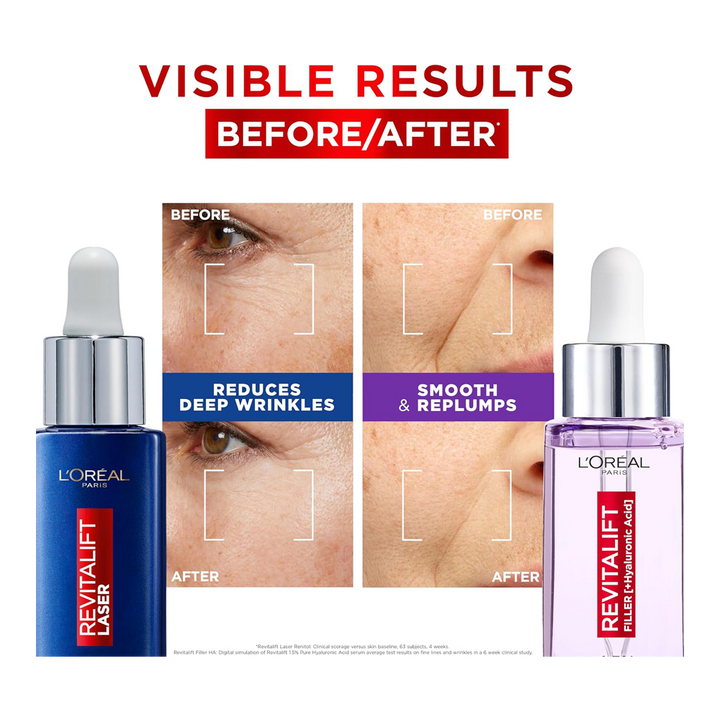 Before and after results using L'Oréal Day & Night Power Serums Set to reduce wrinkles and boost hydration
